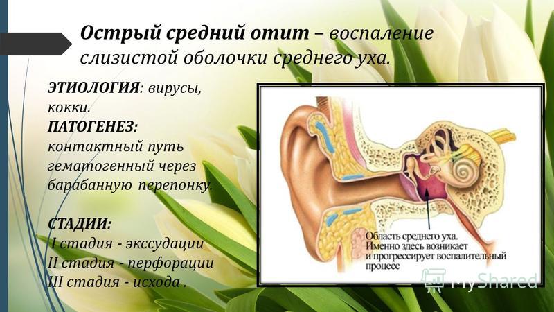 Воспаление внутреннего уха лечение. Хронический Гнойный средний отит этиология. Наружный средний Гнойный отит. Патогенез среднего уха отита. Болезни наружного уха: наружный отит.