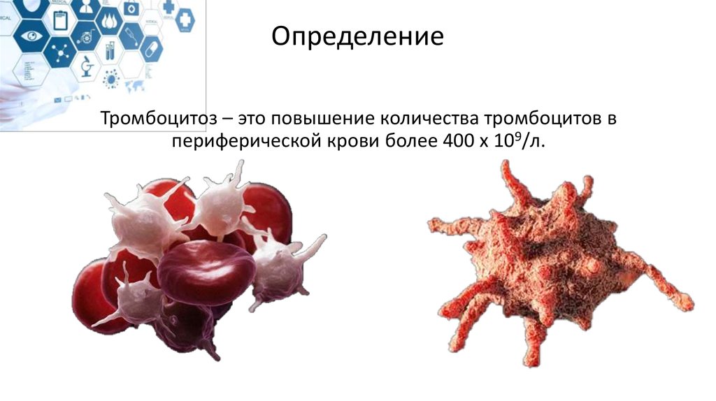 Повышенные тромбоциты рак. Тромбоциты 600. Тромбоциты 800. Тромбоцитоз показатели тромбоцитов.