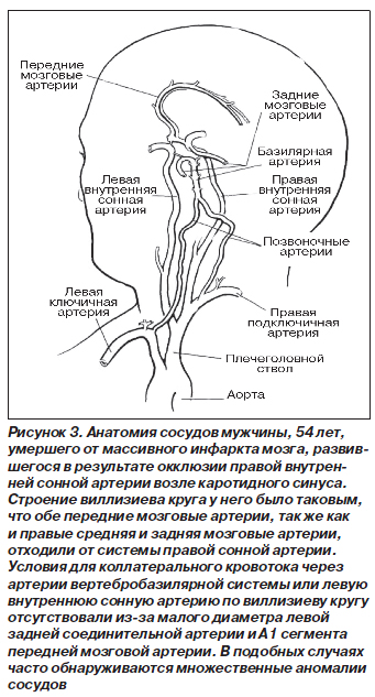 Артерии задних сегментов. Виллизиев круг сегменты артерий. Интракраниальные сегменты внутренних сонных артерий. Внутренняя Сонная артерия сегменты анатомия. Аневризма сонной артерии сегмент с1.