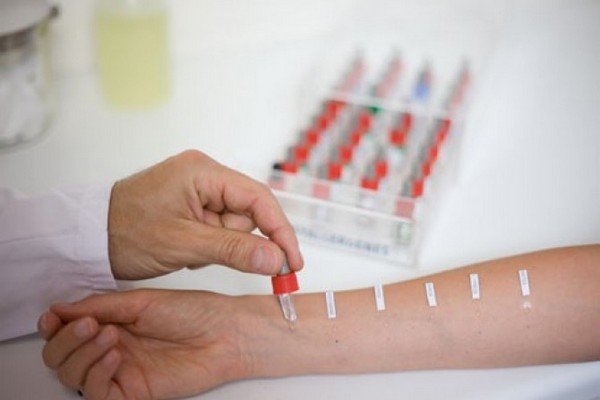 При скарификационных тестах на кожу руки наносят небольшое количество раствора аллергена