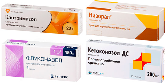 рекомендуемые лекарства: Клотримазол, Низорал, Флуконазол, Кетоконазол