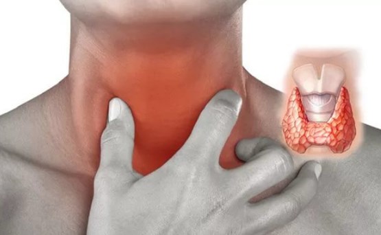 Заболевание щитовидной железы у мужчин