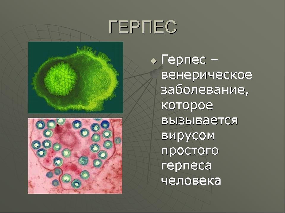 Вирусы через половой путь. Вирусные заболевания герпес. Генитальный герпес этиология.