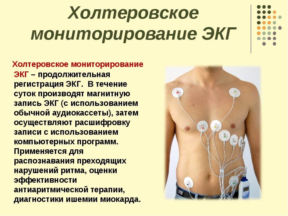 Сердечный мониторинг. Методика холтеровского мониторирования ЭКГ. Схема холтеровский монитора ЭКГ. Суточное мониторирование ЭКГ(холтеровское мониторирование) выявляет. Принципы проведения холтеровского мониторирования.