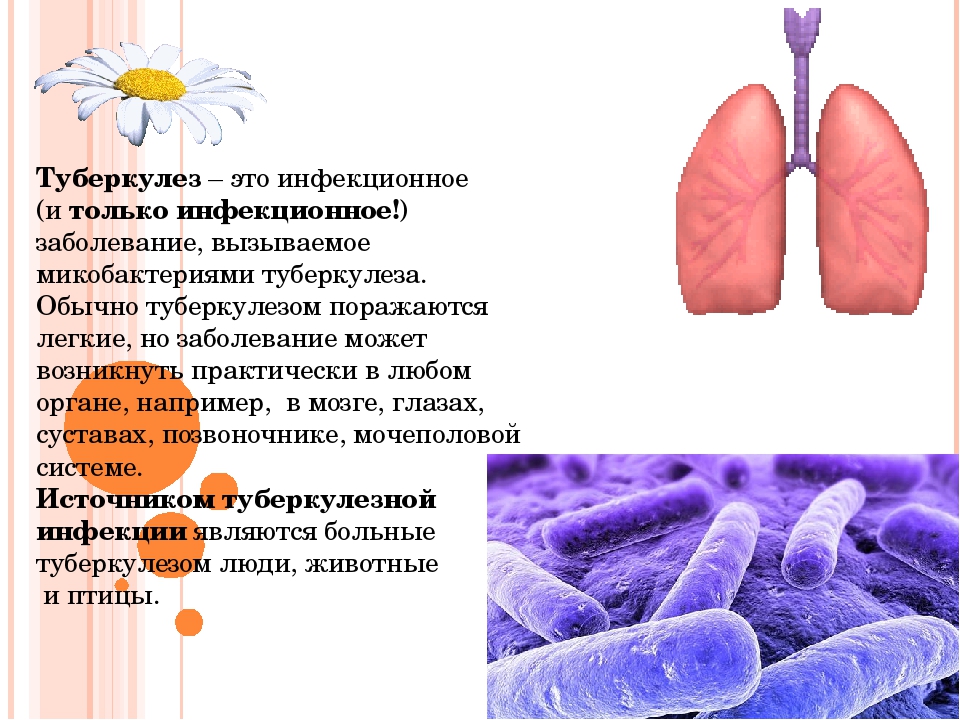 Туберкулез презентация по медицине