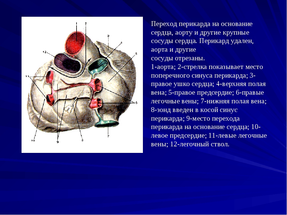 Скопление воздуха в перикарде латынь. Поперечный синус перикарда сердца. Синусы перикарда сердца. Топография перикарда синусы. Синусы перикарда сердца анатомия.