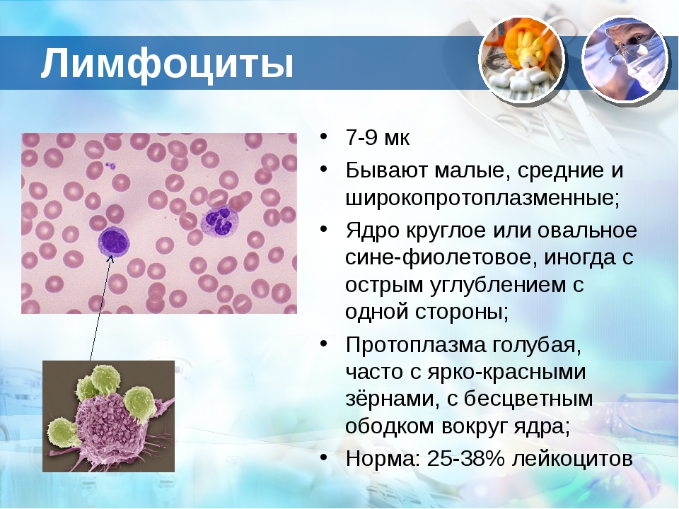 Лимфоциты в крови 12