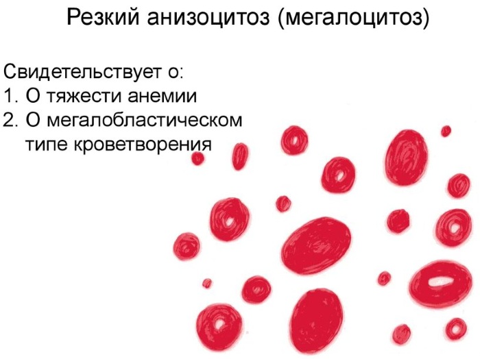 Анизоцитоз в общем анализе крови у взрослых, женщин, ребенка. Причины пониженного, повышенного