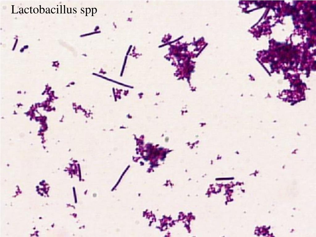 Бактерия spp. Лактобациллы палочки Дедерлейна. Лактобактерии микроскопия. Lactobacillus Acidophilus в микроскопе. Лактобациллы грамположительные.