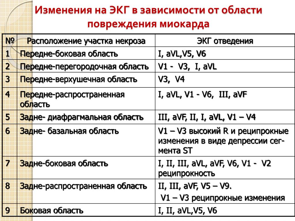 Локализация инфаркта миокарда по экг