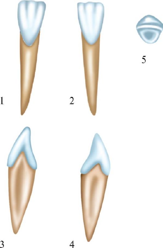 Форма зубов клыки. Латеральный резец верхней челюсти анатомия. Латеральный резец нижней челюсти анатомия. Резец анатомия зуба верхней челюсти. Нижний латеральный резец анатомия.