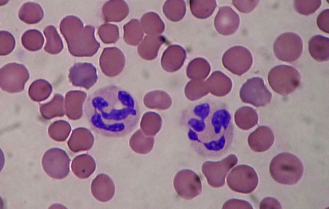 Клетки крови под микроскопом