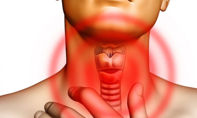 заболевание щитовидной железы