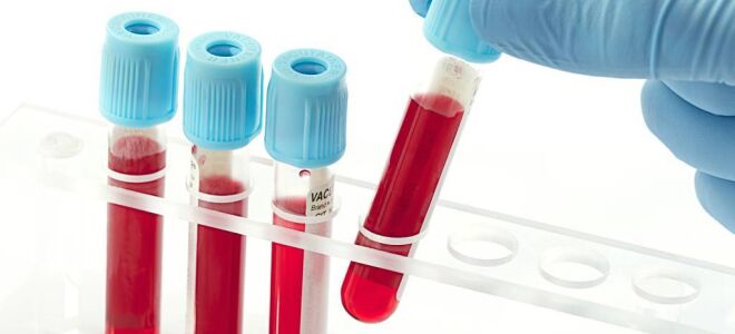 Анализ крови на ПТИ
