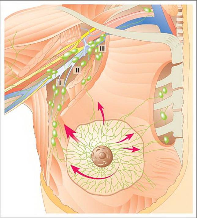 Лимфатические узлы груди. Аксиллярные лимфоузлы в молочной железе что это такое. Регионарные лимфатические узлы молочной железы. Сигнальные лимфоузлы молочной железы. Лимфоузлы молочных желез анатомия.