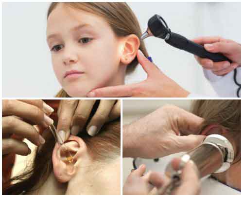 У ребенка заложено ухо но не болит. Ушные пробки у детей причины. Серная пробка отоскопия. Серные пробки в ушах у ребенка.