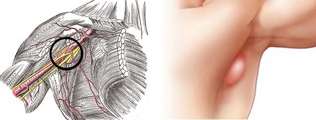 Лимфоузел под мышкой где находятся показать в картинках у женщин