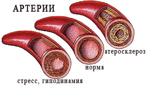 Высокий тромбокрит