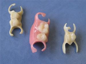Как выглядят протезы бабочка во рту при отсутствии 1-2 зубов: фото до и после микропротезирования