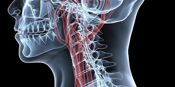 Ком в горле при остеохондрозе появляется из-за компрессии сосудов и воспалений