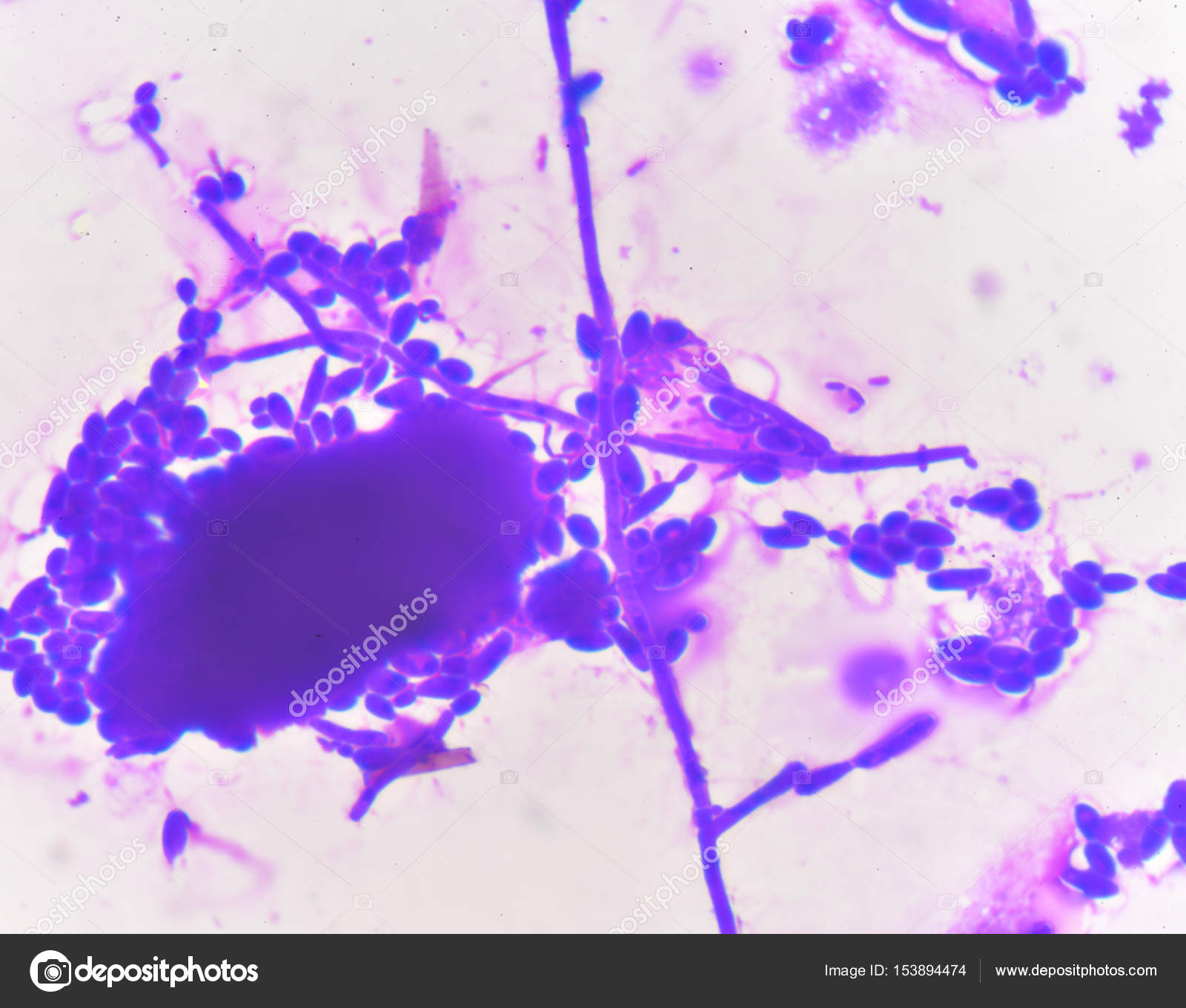 Споры candida. Candida дрожжевые клетки псевдомицелий. Грибы кандида микроскопия. Бластоспоры кандида. Дрожжеподобные грибы: псевдомицелий.