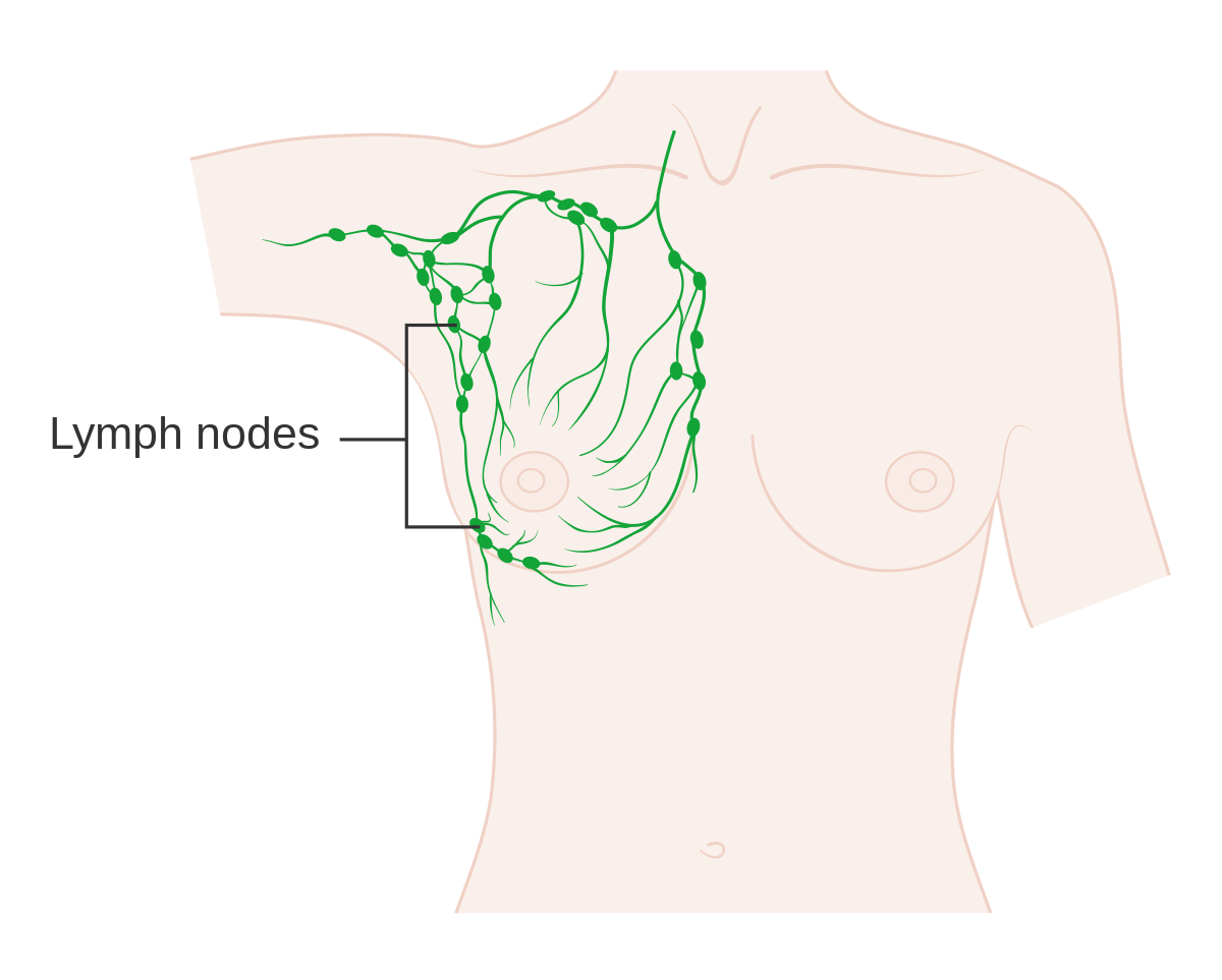 лимфатические узлы груди у женщин фото 27