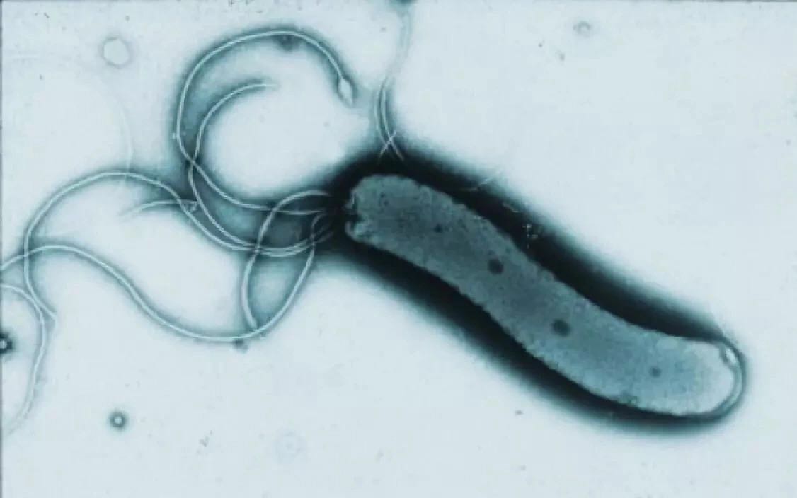 Бактерия вызывающая язву. Бактерия хеликобактер пилори. Бактерия хеликобактер пилори под микроскопом. Helicobacter pylori под микроскопом. Бактерия Helicobacter pylori рисунок.