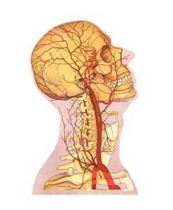  Причины и последствия гипоплазии правой и левой позвоночных артерий