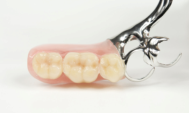 Частичный съемный протез зубов