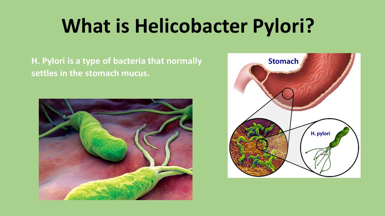 Бактерии хеликобактер причины. Helicobacter pylori микроскопия. Язва желудка хеликобактер. Паразиты хеликобактер пилори. Хеликобактер пилори систематика.