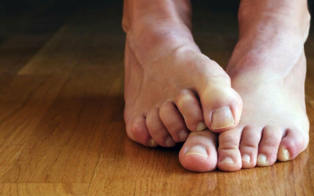 Лечение микоза пальцев ног. Мази